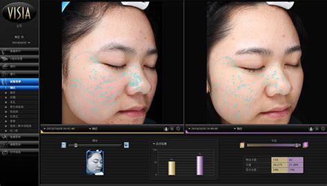 美肤软件测试皮肤准吗(美肤软件测试皮肤准吗知乎)缩略图