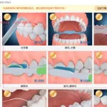 口腔管理软件哪家好(口腔管理软件)缩略图