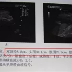 孕育软件胎儿体重准吗,胎儿测算体重软件准吗缩略图