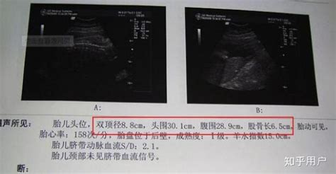 孕育软件胎儿体重准吗,胎儿测算体重软件准吗缩略图