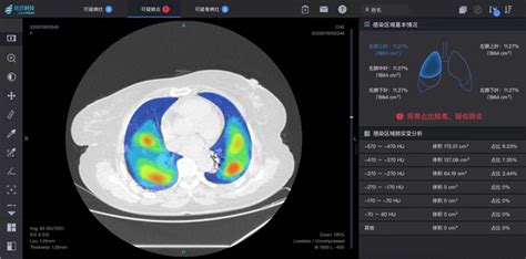 影像科研软件(影像科研软件有哪些)缩略图