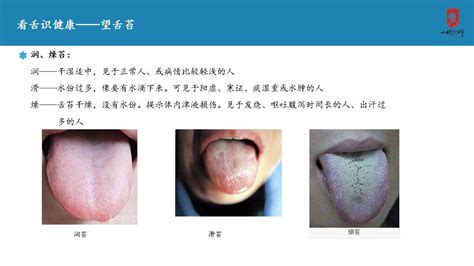 舌头识别健康软件,有没有可以扫描舌头辨症状的软件缩略图