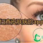 扫一扫图片识别皮肤病,扫一扫图片识别皮肤病男性缩略图